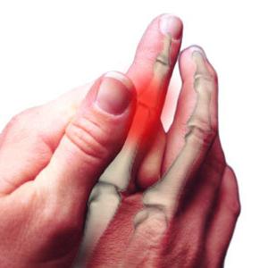 Az ujjak arthritise: kezelés, okok, tünetek