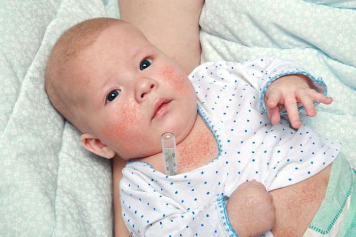 Mennyi ideig tart az angina inkubációs periódus gyermekekben?